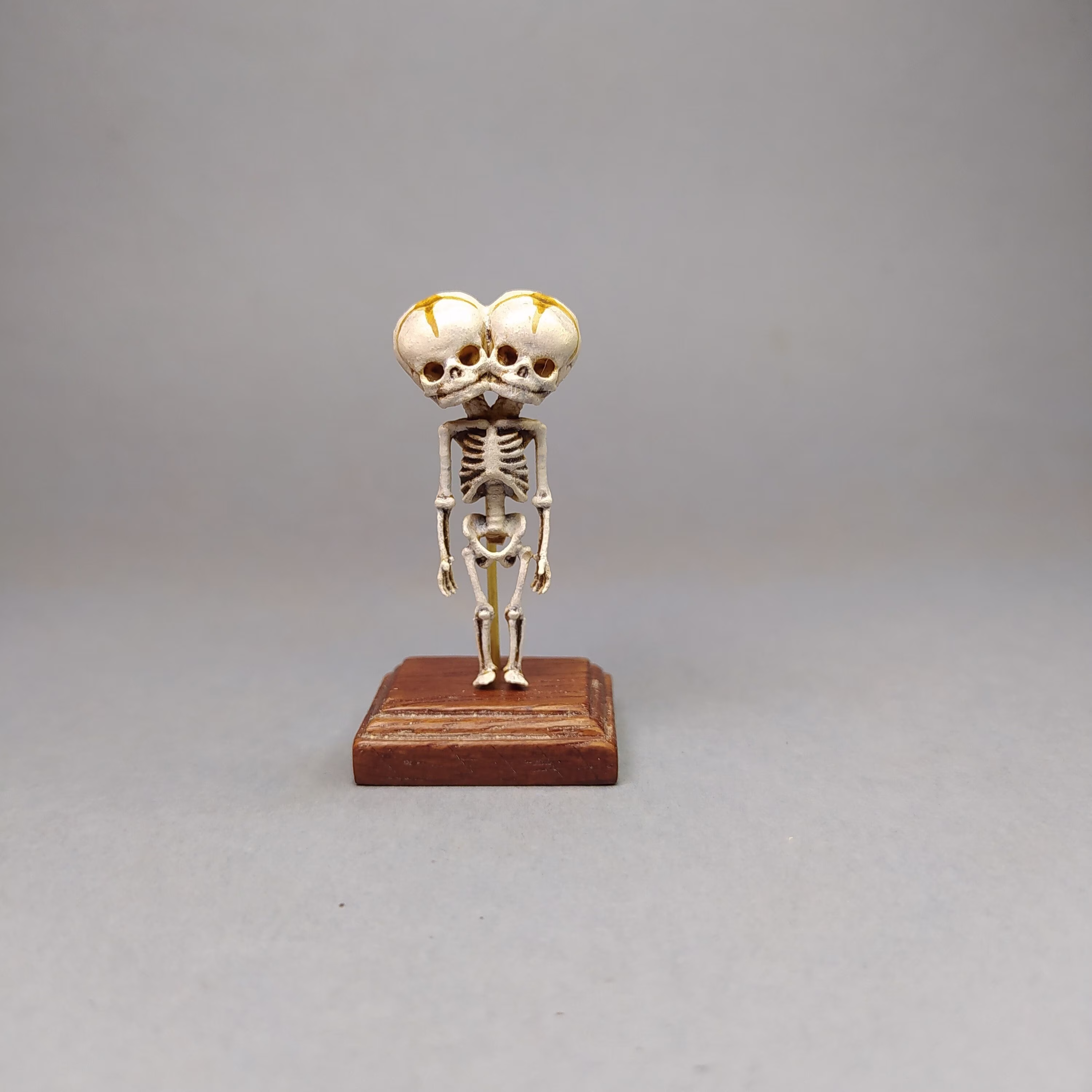 Conjoined Tweens Skeleton. Dicephalus Parapagus Dipus Anatomical Specimen Reproducction. Medical Study Miniature For Dollhouses 112 Scale