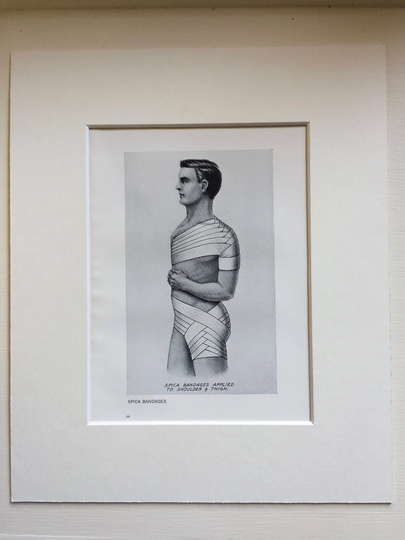 1920S Original Antique Matted Anatomical Print - Bandage Types Spica Bandages Applied To Shoulder & Thigh Anatomy Medicine Doctor