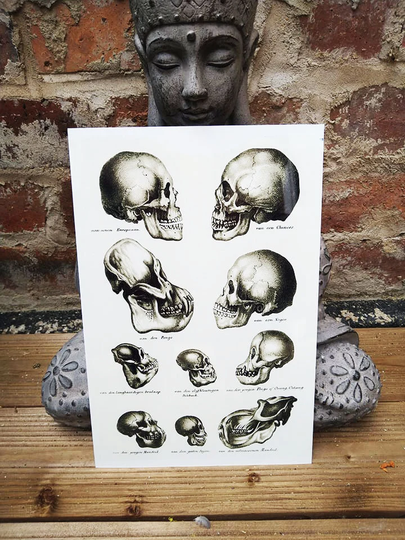 Victorian Skull Anatomy Poster On Aluminium Sheet