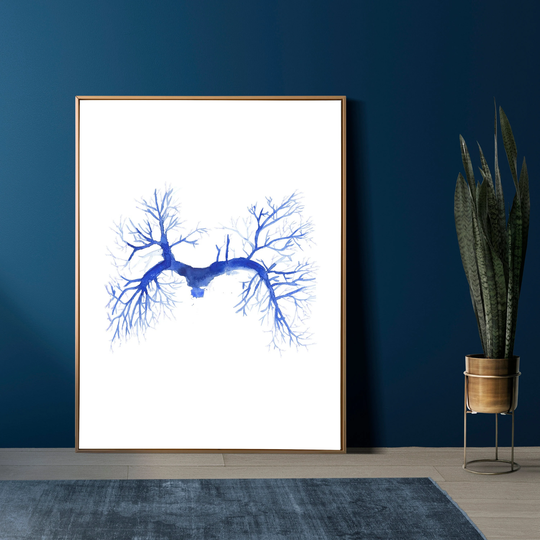 Pulmonary Embolism Angiography, Ct Angio, Radiology Art Print, Medicine Art, Cardiovascular Surgery Critical Care Medical